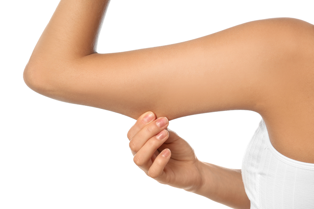 Arm Liposuction